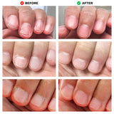 No Bite Nail Recovery | Nail Care - Sumiye Co