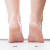 Foot Balm | Skin Care - Sumiye Co